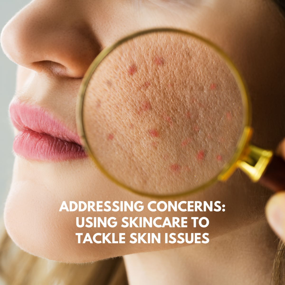 Addressing Concerns: Using Skincare to Tackle Skin Issues