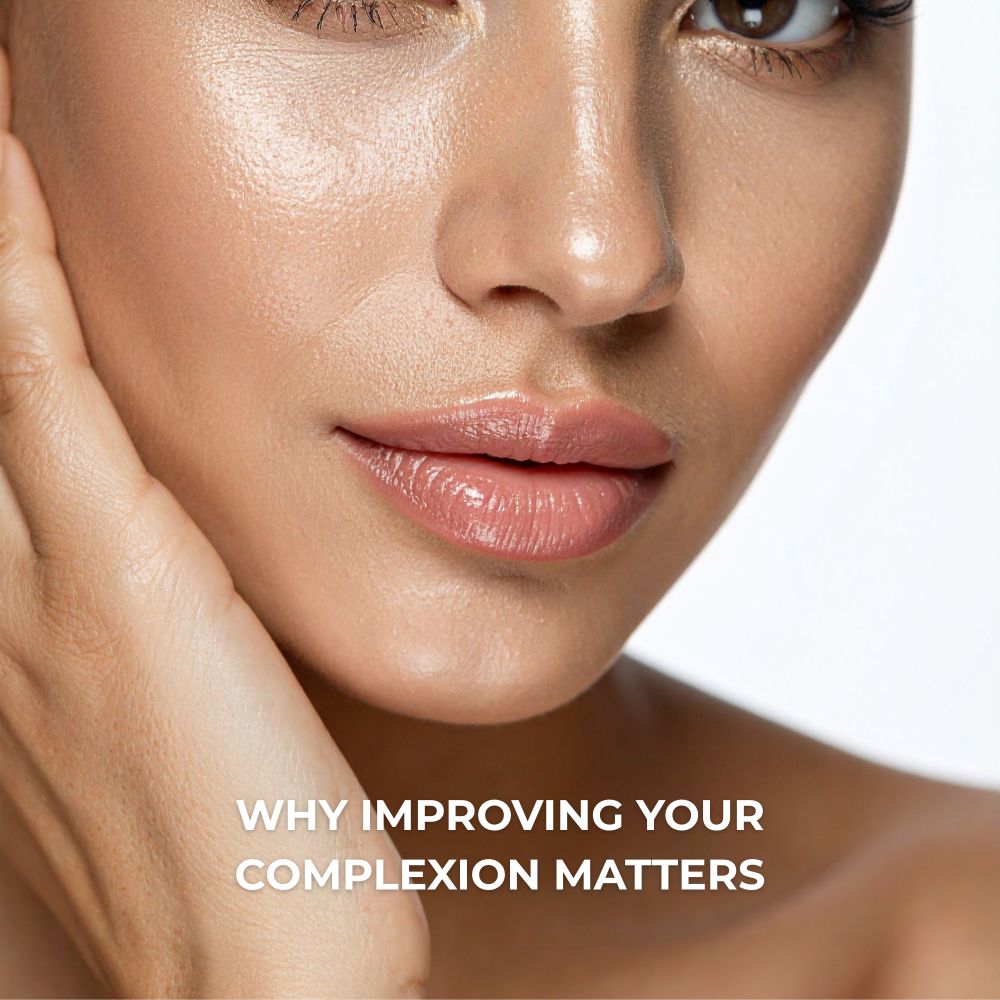 WHY IMPROVING YOUR COMPLEXION MATTERS