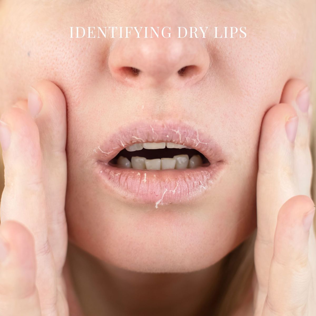 identifying dry lips